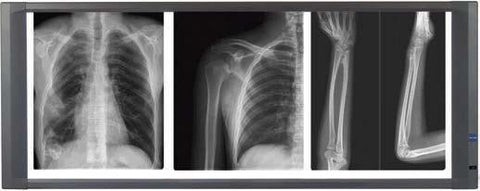 NEGATOSCOPIO LED 3 campos | MedLight | Médicos